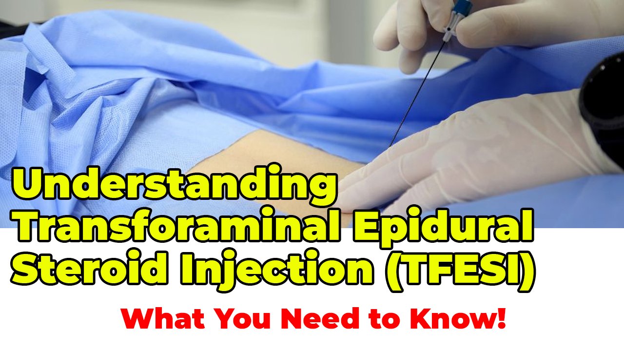 Understanding Transforaminal Epidural Steroid Injection (TFESI): What You Need to Know