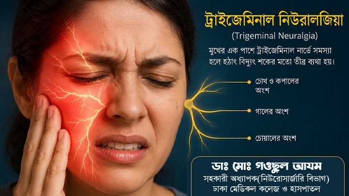 মুখে বিদ্যুৎ শকের মতো ব্যথা? হতে পারে ট্রাইজেমিনাল নিউরালজিয়া!