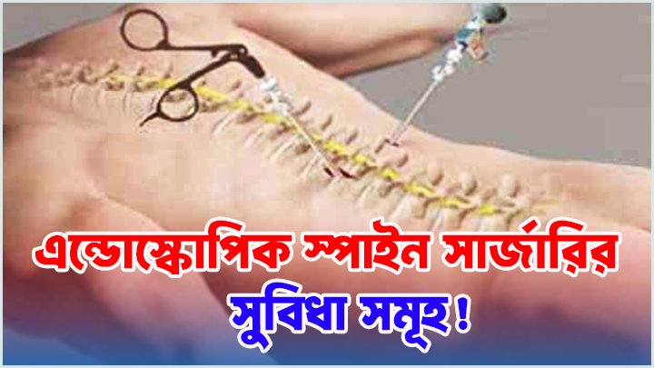 এন্ডোস্কোপিক স্পাইন সার্জারি: আধুনিক মেরুদণ্ড চিকিৎসা