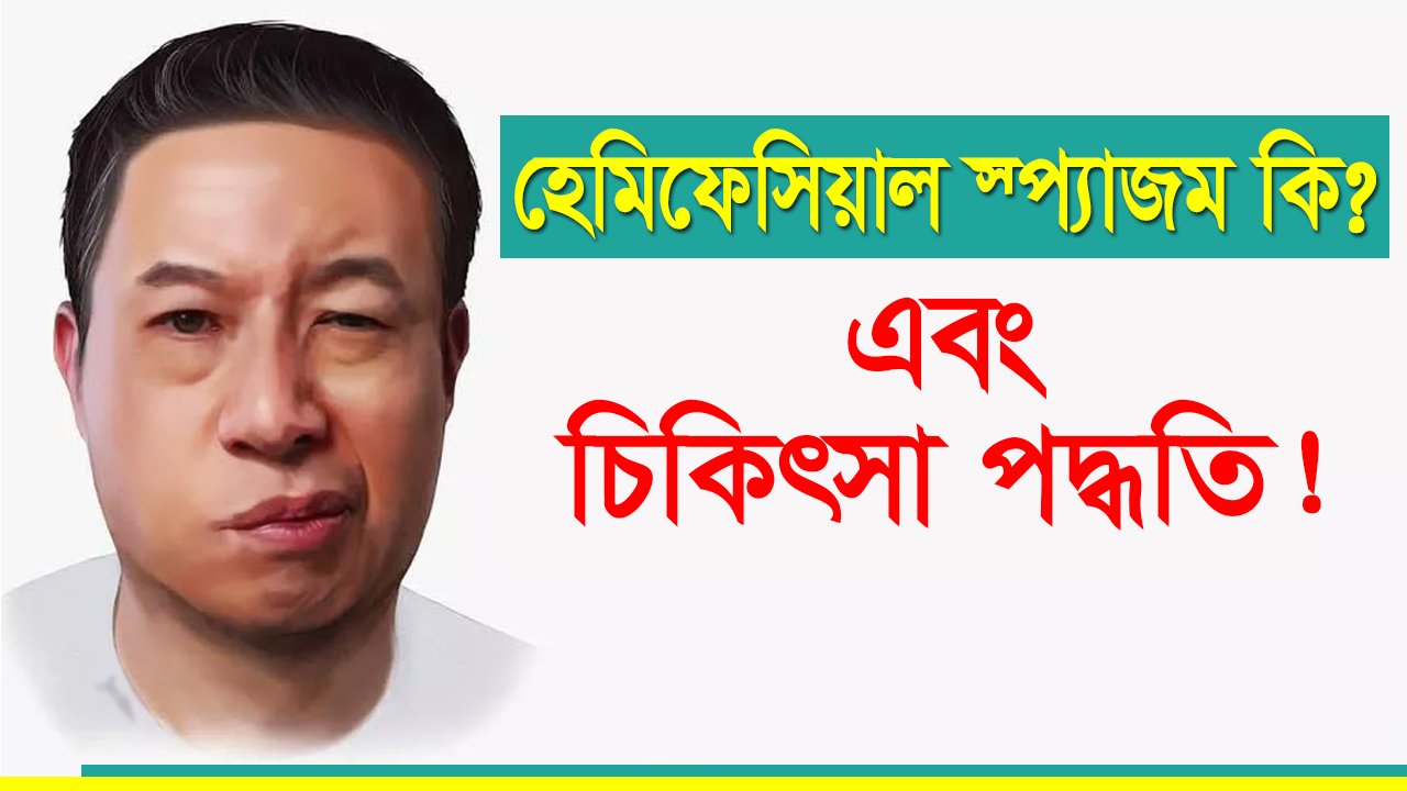 হেমিফেসিয়াল স্প্যাজম কি? কারণ ও চিকিৎসা পদ্ধতি