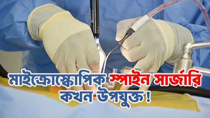 মাইক্রোস্কোপিক মিনিমালি ইনভেসিভ স্পাইনাল সার্জারি সুবিধা!