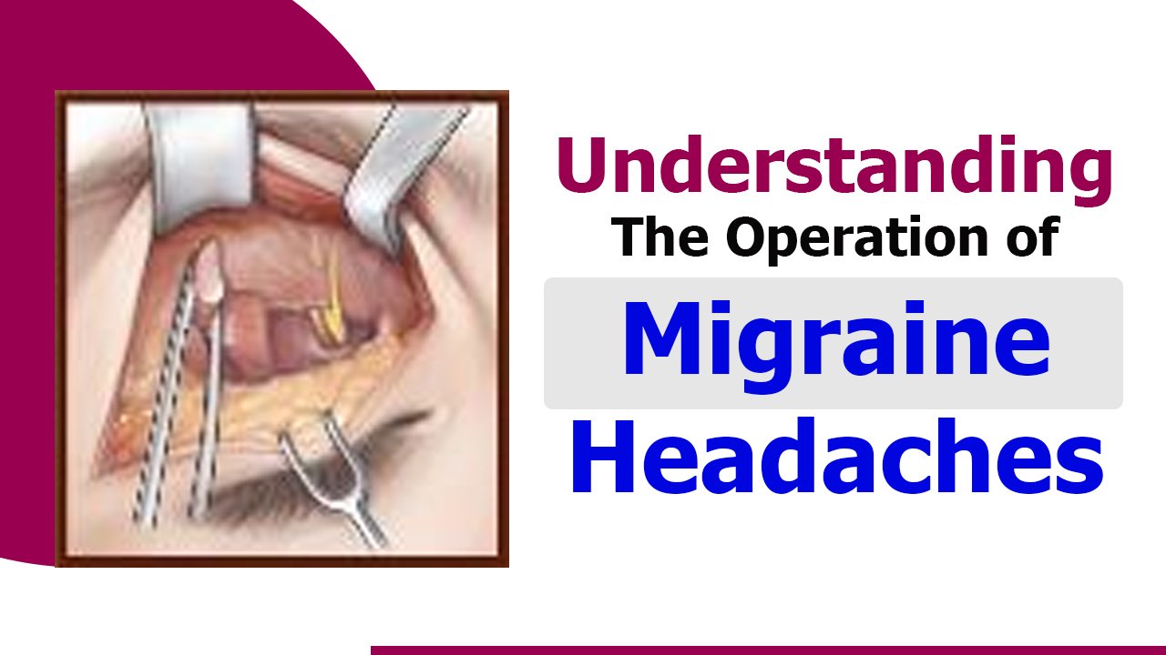 Understanding the Operation of Migraine Headaches | Causes & Treatments