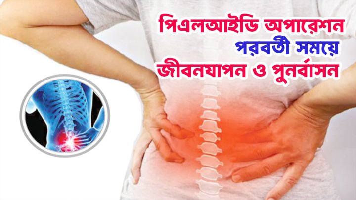 PLID সার্জারি পরবর্তী সময়ে সঠিক জীবনযাপন ও পুনর্বাসন!