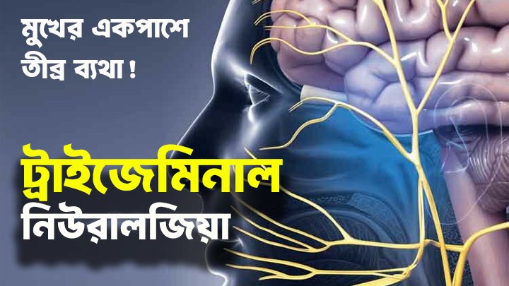 অসহনীয় মুখের ব্যথা: ট্রাইজেমিনাল নিউরালজিয়া (TN) এর কারণ ও চিকিৎসা