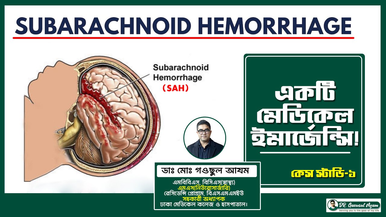 কেস স্টাডি-১  Subarachnoid Hemorrhage (SAH) একটি মেডিকেল ইমার্জেন্সি!