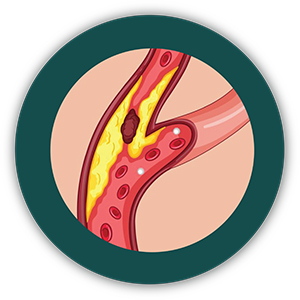 Peripheral Nerve Surgery
